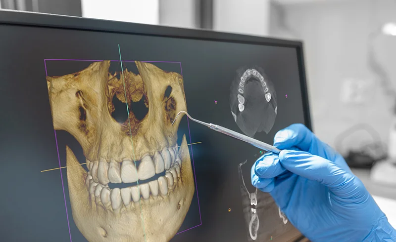 3D-dental-xray