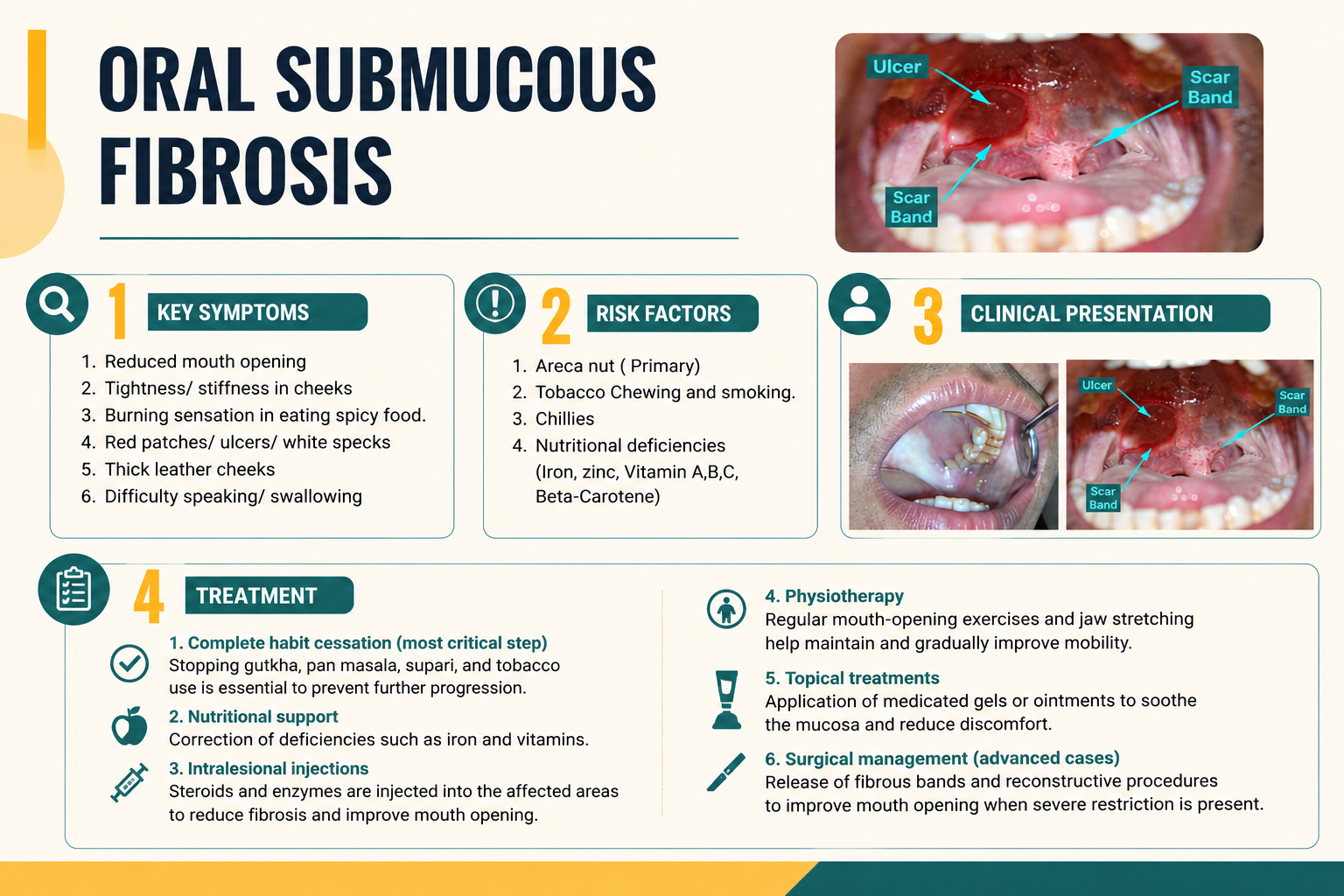 oral-submucous-fibrosis